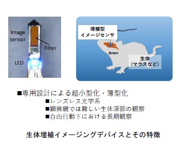 生体埋植イメージングデバイスとその特徴